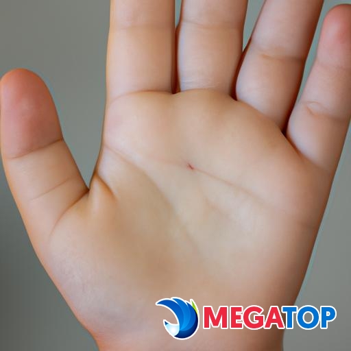 Gần cận của bàn tay một đứa trẻ hiển thị các đường nét lòng bàn tay và một nốt ruồi.